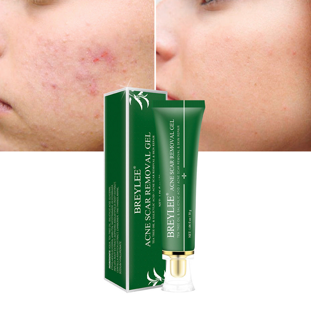 Gel Réparateur Anti-Cicatrices d’Acné – Arbre à Thé & Acide Salicylique | Sérénaya