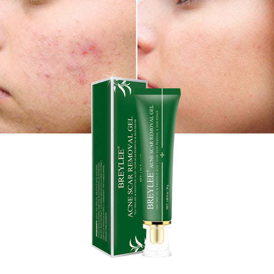 Gel Réparateur Anti-Cicatrices d’Acné – Arbre à Thé & Acide Salicylique | Sérénaya